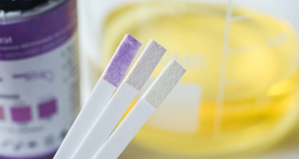 Cbd oil benefits_Does CBD show up in drug tests